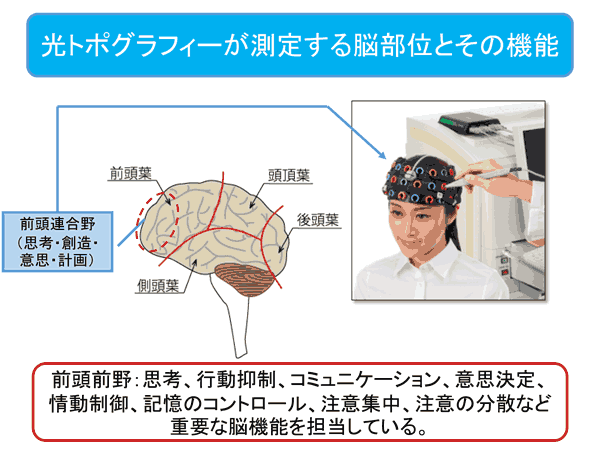 光トポグラフィー検査