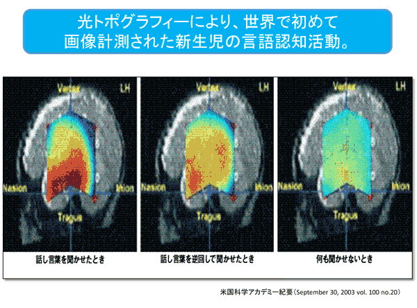 光トポグラフィー検査